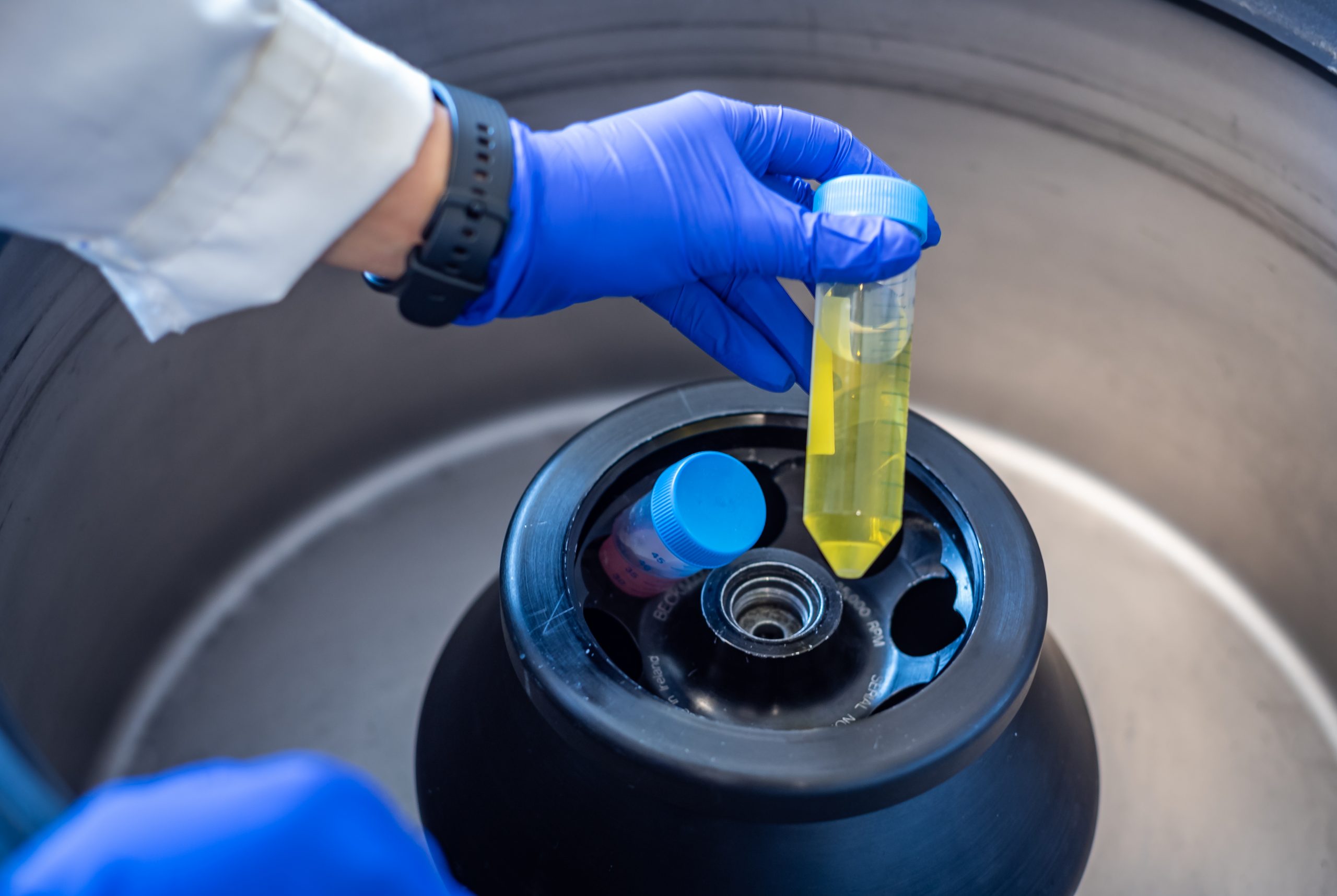 Centrifugeuse un élément essentiel Kalstein