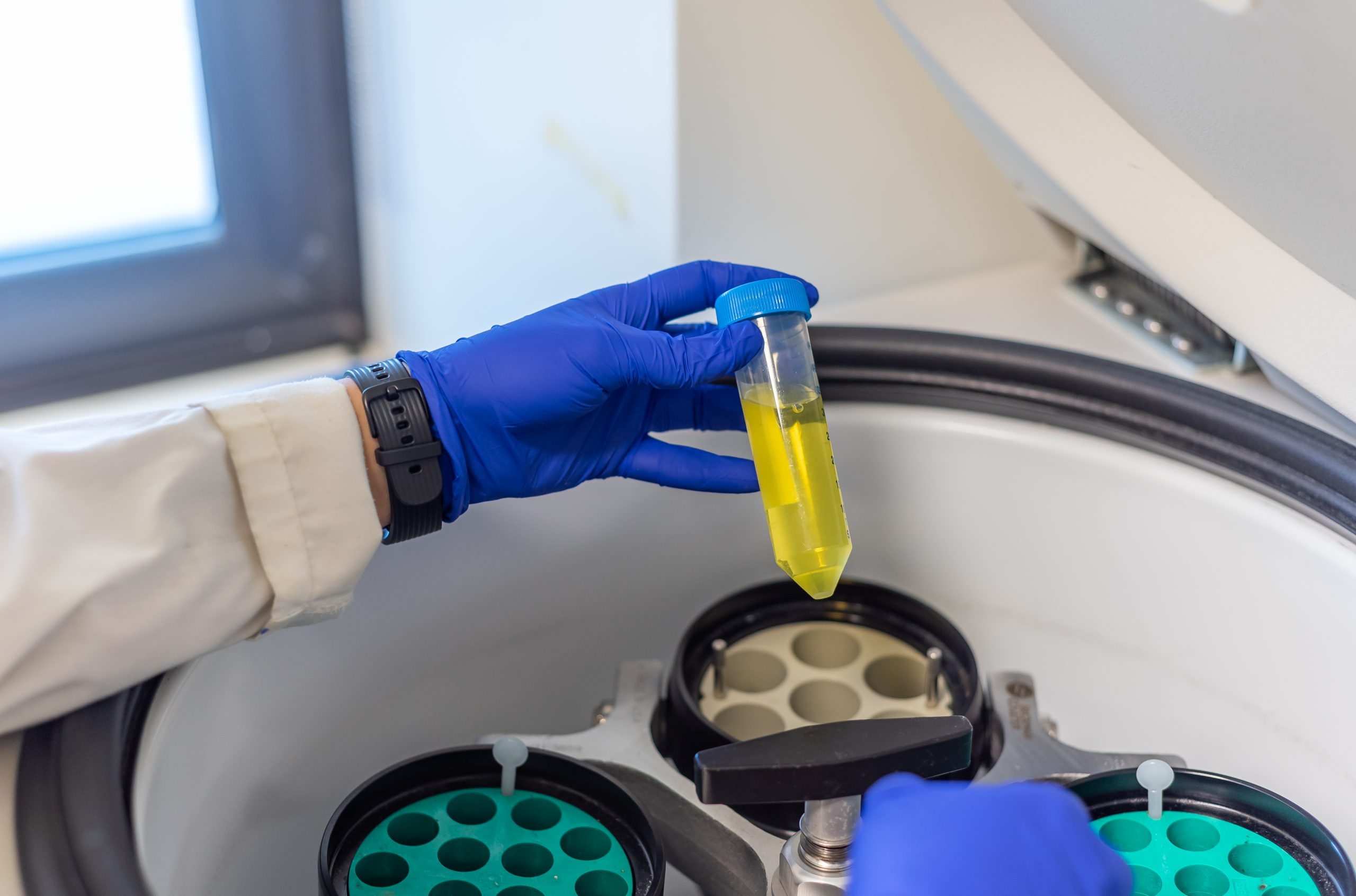 Qu'estce qu'une centrifugeuse ? Kalstein